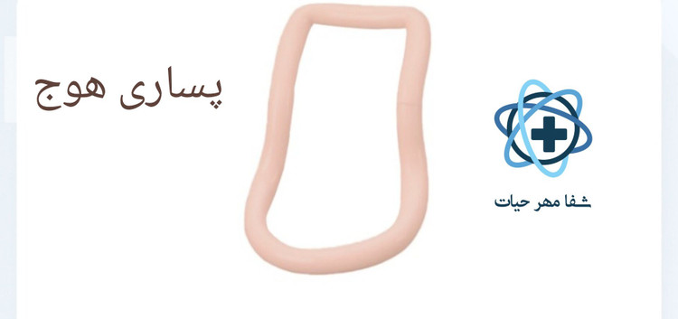 پساری هوج
